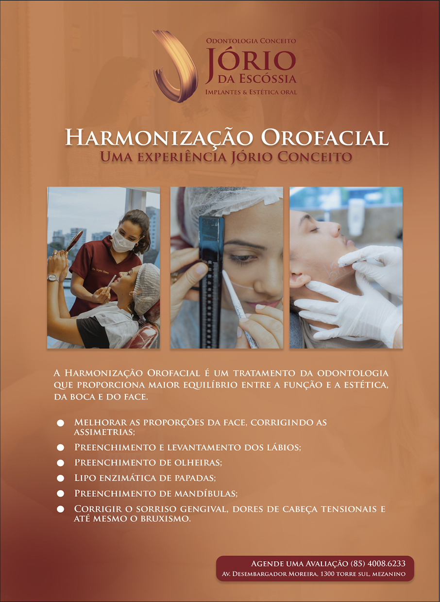 Miolo Inconnection #39 Dego Villar103