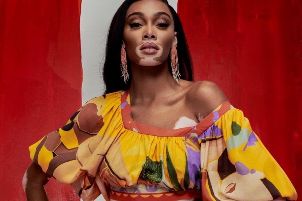 Top model Winnie Harlow será a musa do Camarote Brahma nº1