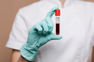 Exame De Sangue Teste Teste Laboratorial Exame Laboratorial Saúde Farmácias Laboratório