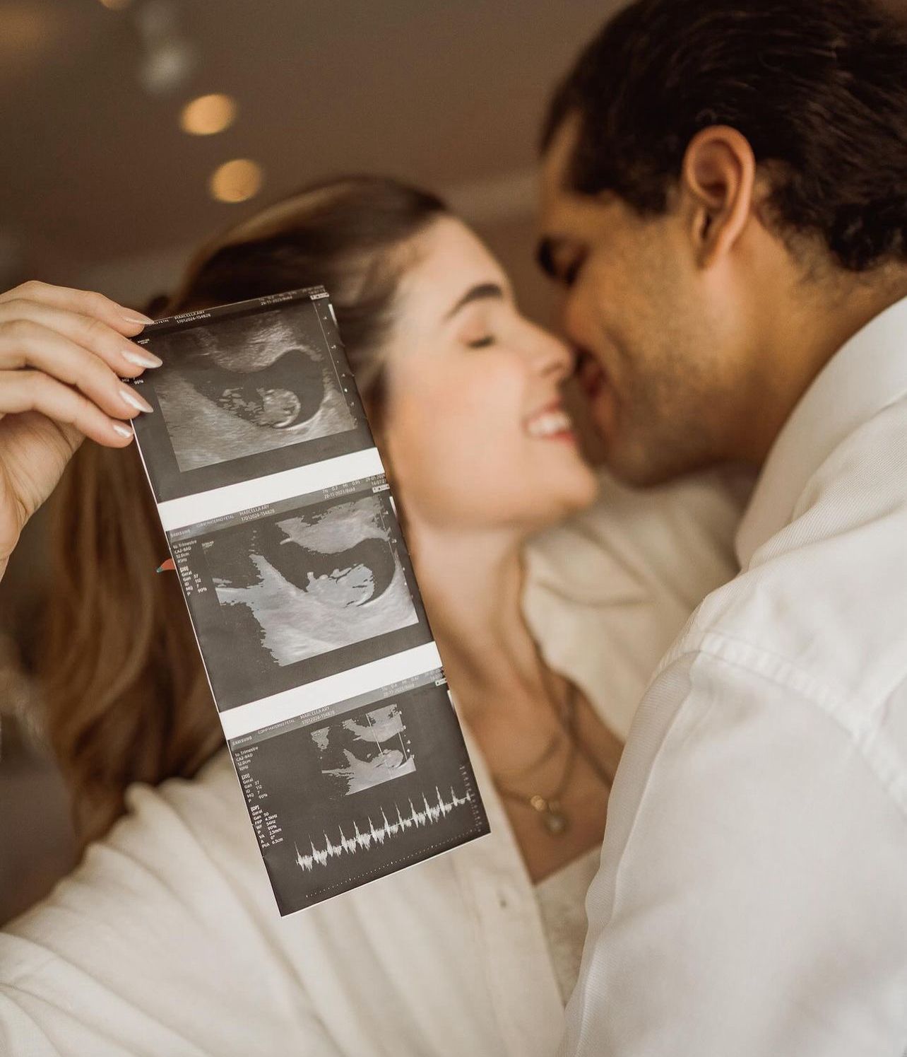 Marcella e Victor Ary assinam 1º contrato com Dona Cegonha