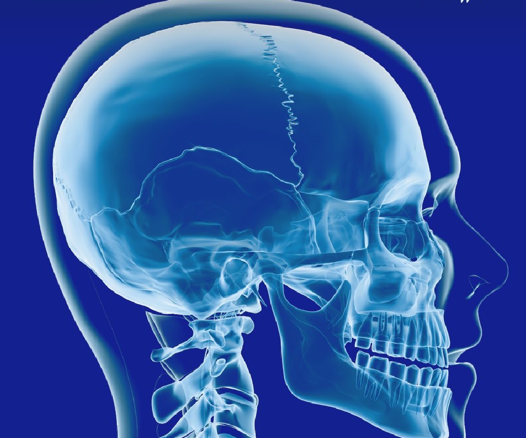 Simpósio De Cranioestenoses De Fortaleza